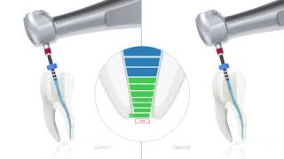 VDW Dental · How To VDWROTATE  Step by step [upl. by Ogaitnas]