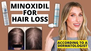 Dermatologist Explains How Minoxidil Works for Hair Loss How to Use Results amp More [upl. by Shannah182]