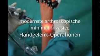 ARTHROSKOPISCHE HANDGELENK OPERATION minimal invasive Handgelenksoperation Handgelenk Op [upl. by Tnek98]