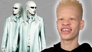 People With Albinism Review Albino Characters From Film [upl. by Krasnoff566]