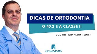 Dicas de ortodontia O 4X2 e a Classe II [upl. by Retsevlis]