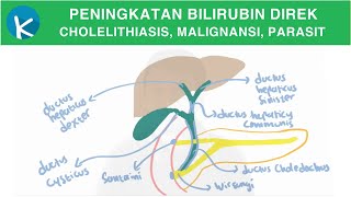 Patofisiologi Ikterus 2B2B  Peningkatan Bilirubin Direk Kolestasis Ekstrahepatik [upl. by Johan]