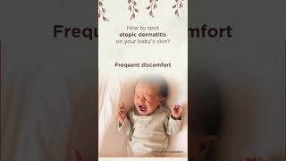 How to Identify and Soothe Atopic Dermatitis with the Best Baby Cream [upl. by Woodrow]