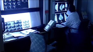 FDA now requires mammogram reports to include breast density information [upl. by Enelyak554]