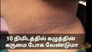 10 நிமிடத்தில் கழுத்தின் கருமை போக வேண்டுமாhow to remove dark neck in Tamil dark neck remedyTamil [upl. by Anaib]