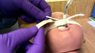 How to secure neonate ETT [upl. by Boutis979]