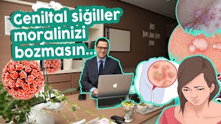 GENİTAL SİĞİL💥 TEDAVİSİ Siğil nasıl bulaşır Belirtileri nedir Kesin tedavisi var mı Siğil aşısı [upl. by Fogg]