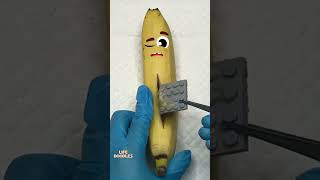 Life Doodles  Operation on banana ate lego😂 Fruitsurgery doodles lifedoodles shorts shortvideo [upl. by Tjader]