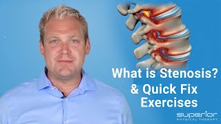 What is Stenosis amp Sciatica  Test for Stenosis amp Sciatica  Quick Fix Exercises  Dr A Gorecki [upl. by Ferreby325]