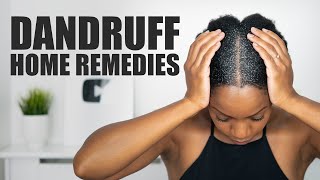 8 HOME REMEDIES to FIGHT DANDRUFF [upl. by Arivle]