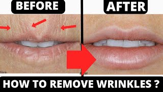 3 WAYS TO GET RID OF LIPS WRINKLES amp SMOKER LINES [upl. by Oeht]