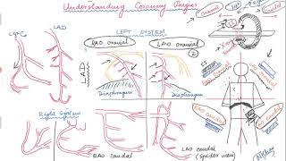 Basics of angiographic views during left heart catheterization [upl. by Mehs]