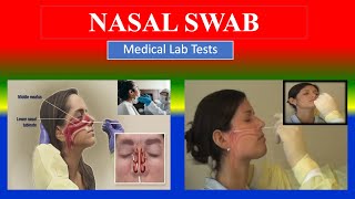 NASAL SWAB   Medical Lab Tests  What is   Uses  Need  Preparation  Results [upl. by Main]