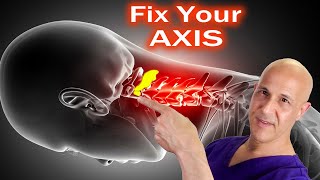 Fix Your Axis and Expect Miracles Dr Mandell [upl. by Aiet]