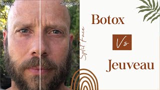 Jeuveau  Jeuveau vs Botox split face study [upl. by Lahey]