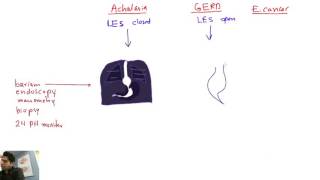 esophagus pathology [upl. by Ycats]