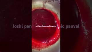 ayurveda vitiated blood Emesis of blood post hirudotherapy Rakthdosh Rakthduddhi Detox Blood [upl. by Eellehs]