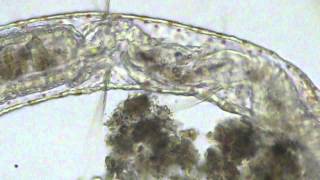 Aeolosoma Feeding Cycle [upl. by Freud]