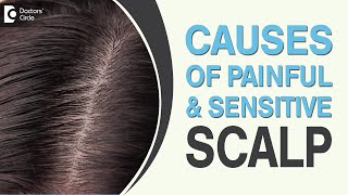 What are the causes of a sensitive and painful scalp  Dr Amee Daxini [upl. by Jaclin]