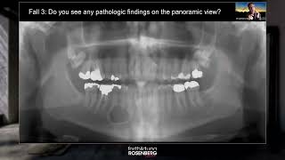 Trailer «Zahnärztlichradiologisches Quiz» – Prof Dr Michael Bornstein [upl. by Llesirg]