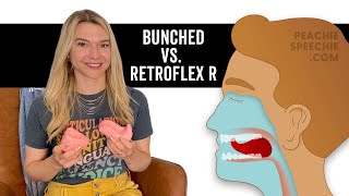 Bunched R vs Retroflex R Tongue Placement by Peachie Speechie [upl. by Madeleine37]