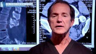 Epidural Steroid For Lumbar Spinal Stenosis Pros and Cons by Dr Tony Mork [upl. by Kliman]