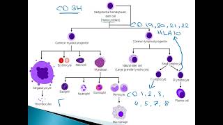 Acute Lymphocytic Leukemia ALL in pediatrics [upl. by Yennek]