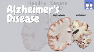 Alzheimers Disease Dementia Nursing Symptoms Treatment Stages Pathophysiology NCLEX [upl. by Cammi182]