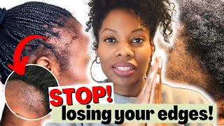 Grow Your EDGES BACK Fast Thicker With This Regimen  How To Treat Traction Alopecia [upl. by Dehlia]