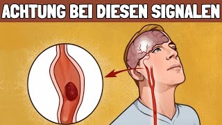 Vor einem Schlaganfall sendet dir dein Körper diese Signale [upl. by Tallbott]