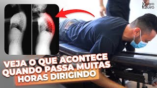 QUIROPRAXIA PARA HIPERCIFOSE E DORES NA CERVICAL [upl. by Leahicm]