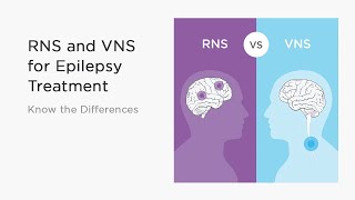 RNS and VNS for Epilepsy Treatment  Know the Differences [upl. by Kenison651]