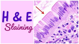 H amp E staining  Hematoxylin amp Eosin staining [upl. by Notsyrb]