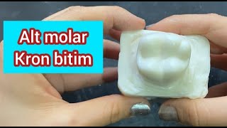 Sabundan Alt 1 Molar Diş Yapımı Kron Bitim  Mandibular First MOLAR [upl. by Akiret]