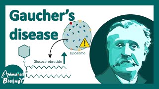 Gauchers disease  classification symptoms pathology of Gauchers disease [upl. by Holleran]