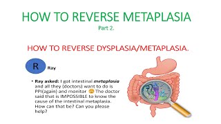 Metaplasia dysplasia How to reverse dysplasia metaplasia Causes of metaplasia [upl. by Kimmel835]