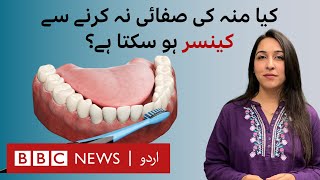 Can poor oral hygiene lead to serious diseases  BBC URDU [upl. by Hsekar]