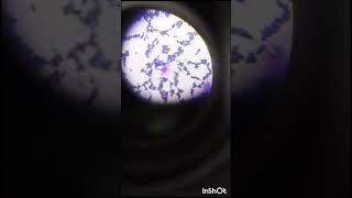 Candida albicans 100x oil immersion [upl. by Madeline]