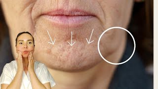 8 min massage for SAGGING JOWLS and chin tension [upl. by Anazus]