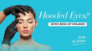 Understanding Hooded Eye Botox Eyebrow Lift [upl. by Ilac]