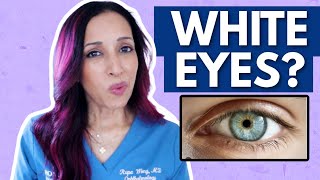 Why Your Eyes Arent White  Eye Doctor Explains [upl. by Telocin]