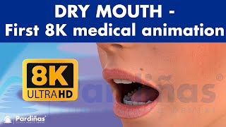 DRY MOUTH  Causes and remedies of xerostomia  WORLDS FIRST MEDICAL ANIMATION IN 8K © [upl. by Lacefield266]