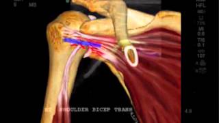 Fallstudie FujiFilm SonoSite Pathologie der Vorderschulter [upl. by Nueovas986]