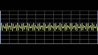 Q Fever Coxiella burnetiiRickettsia  Rife Frequencies [upl. by Servais]