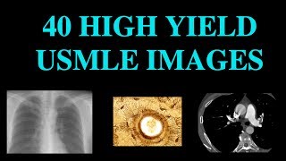 40 High Yield Images for USMLE CT XRay Histology [upl. by O'Gowan]