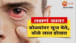 Conjunctive eyes  सावधान राज्यात झपाट्याने पसरतेय डोळे येण्याची साथ कशी घ्याल काळजी पाहा [upl. by Airehc]