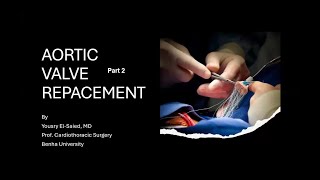 Aortic Valve Replacement Part 2 [upl. by Maziar]