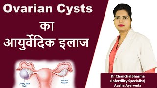 Ovarian Cyst का आयुर्वेदिक इलाज in Hindi  Dr Chanchal Sharma [upl. by Darnall]