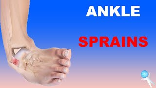 Ankle Sprains  Lateral and Deltoid Ligaments High Ankle Sprains [upl. by Dahraf292]