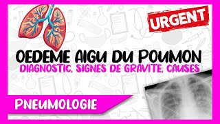 L Œdème Aigu Du Poumon Diagnostic Positif et Différentiel Causes et Facteurs Déclenchants [upl. by Mervin]